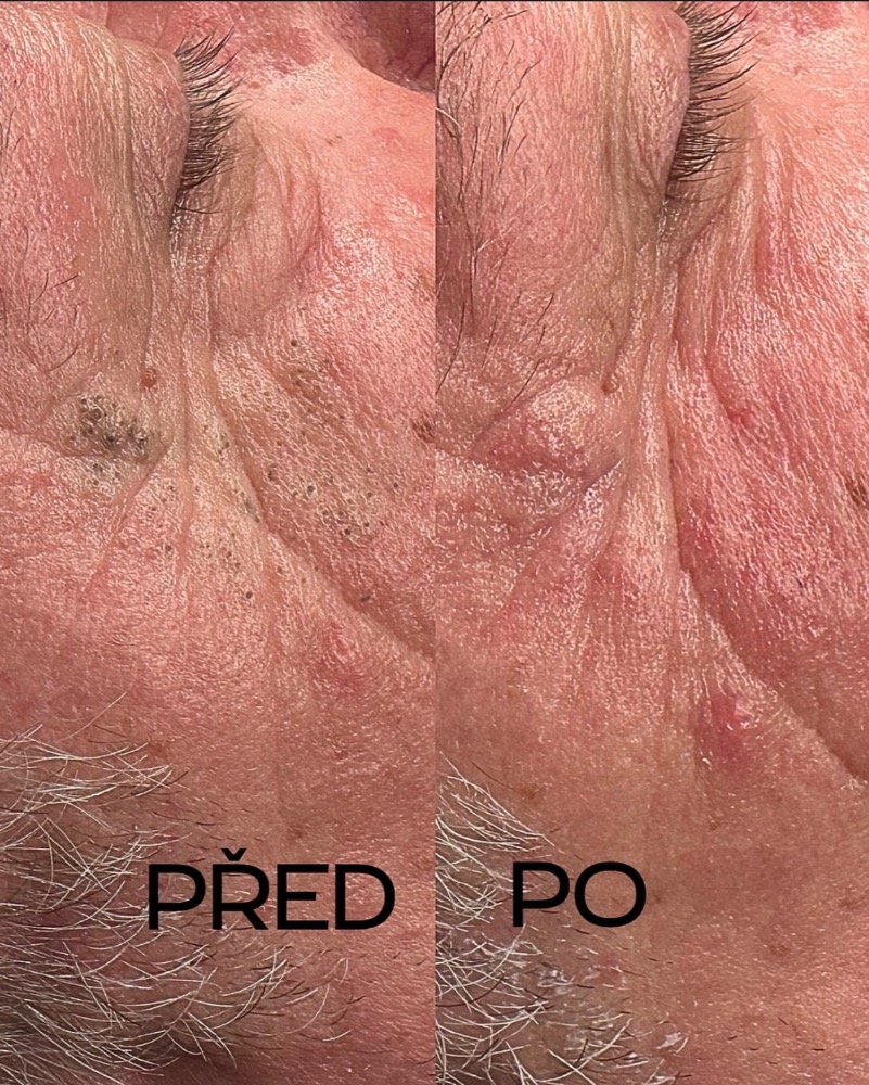 Kosmetika- hloubkové čištění Plzeň