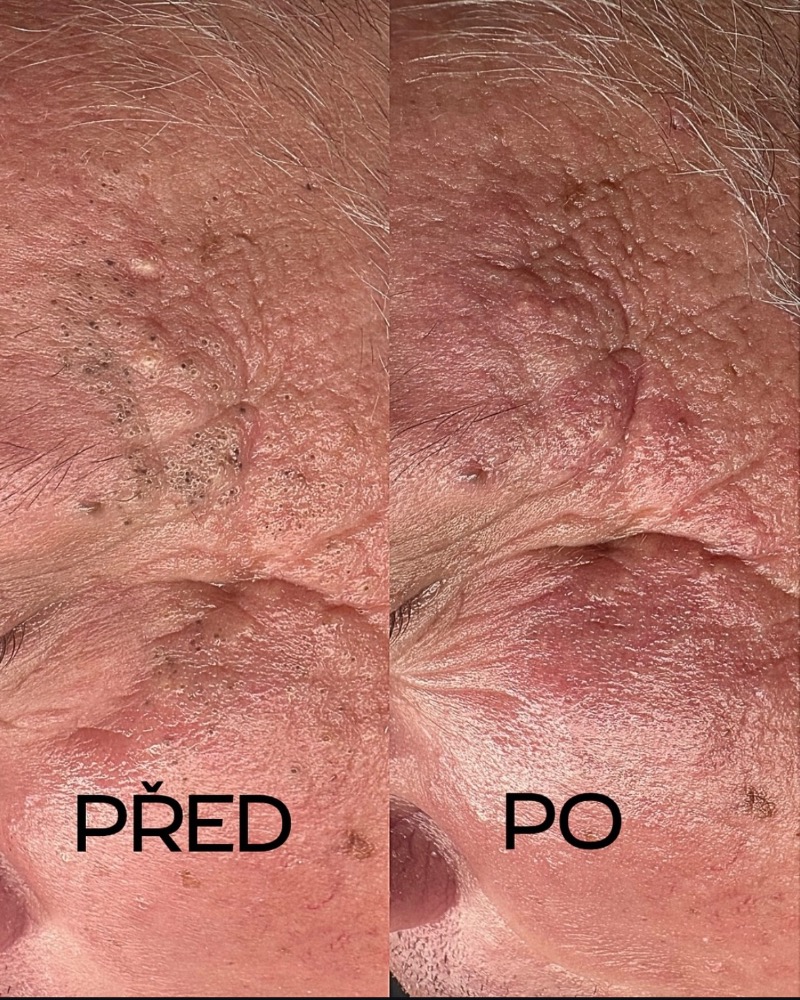 Kosmetika- hloubkové čištění Plzeň