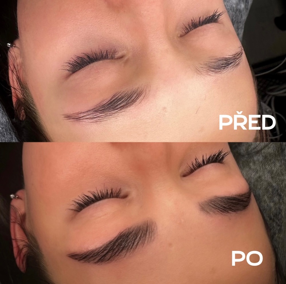 Laminace obočí Plzeň -před a po