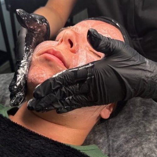 Ošetření pleti Plzeň - Červený hrádek