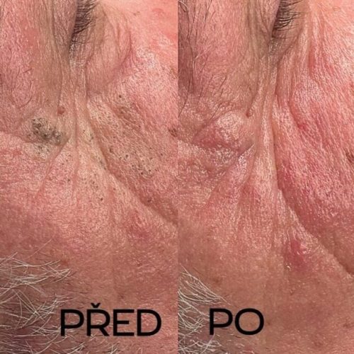 Kosmetické ošetření Plzeň