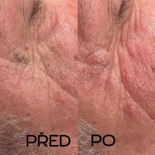 Kosmetika- hloubkové čištění Plzeň