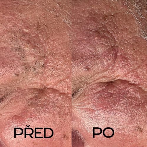 Kosmetika- hloubkové čištění Plzeň