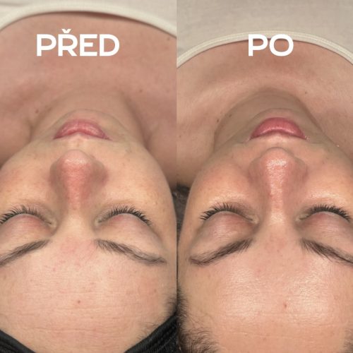 Kosmetické ošetření Plzeň