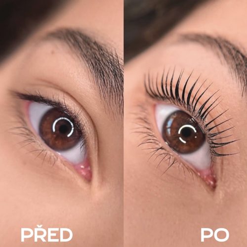 Laminace řas Plzeň-před a po