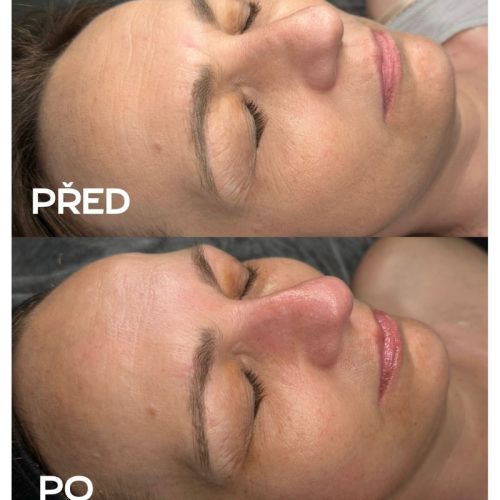 Kosmetické ošetření Plzeň